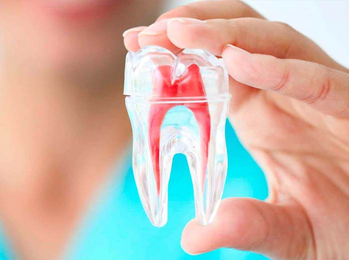 Imagem endodontia